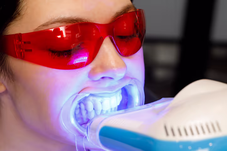 Close-up of a woman wearing red protective glasses undergoing a teeth whitening procedure with a specialized blue light device.